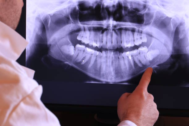 Emergency Dentist for Kids in UT